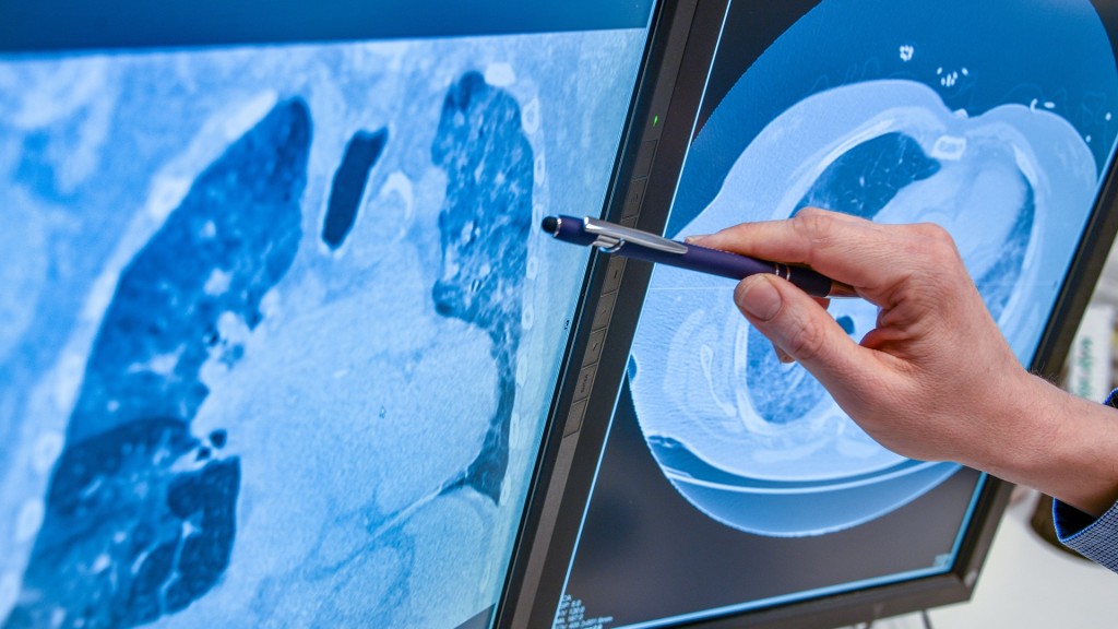 Foto: Ein Radiologe untersucht einen CT Befund einer Lunge