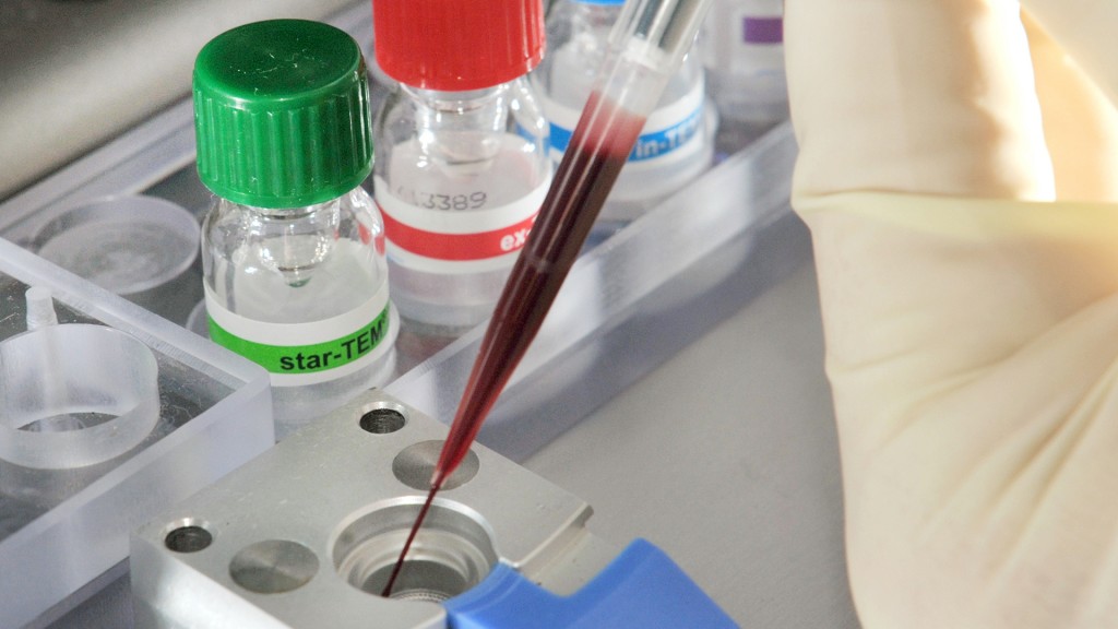 Sepsis Untersuchung