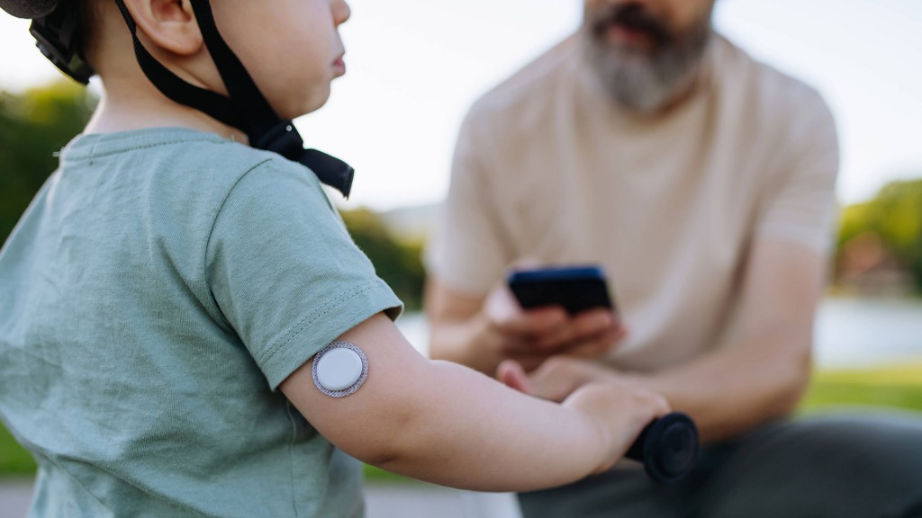 Ein Vater misst den Blutzuckerspiegel seines kleinen Sohnes mithilfe eines CGM-Sensors und einer mobilen App
